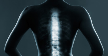 Human backbone in x-ray